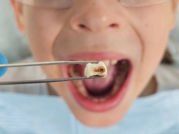 Best Pediatric Emergency Dentist in Advance, MO